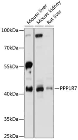 Invitrogen PPP1R7 Polyclonal Antibody 100 &mu;L; Unconjugated:Antibodies,