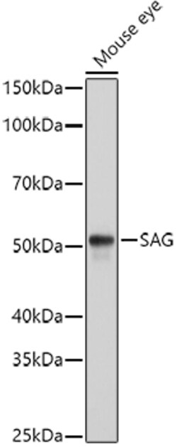 Invitrogen S-arrestin Polyclonal Antibody 100 &mu;L; Unconjugated:Antibodies,