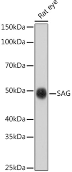 Invitrogen S-arrestin Polyclonal Antibody 100 &mu;L; Unconjugated:Antibodies,