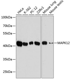 Invitrogen p38 MAPK gamma Polyclonal Antibody 100 &mu;L | Buy Online | Invitrogen&trade; | Fisher Scientific