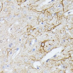 Invitrogen TBCA Polyclonal Antibody 100 &mu;L; Unconjugated:Antibodies,