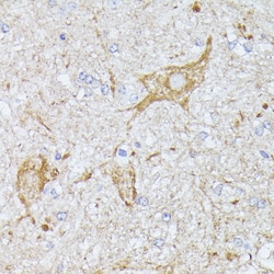 Invitrogen TBCA Polyclonal Antibody 100 &mu;L; Unconjugated:Antibodies,