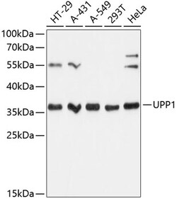 Invitrogen UPP1 Polyclonal Antibody 100 &mu;L; Unconjugated:Antibodies,