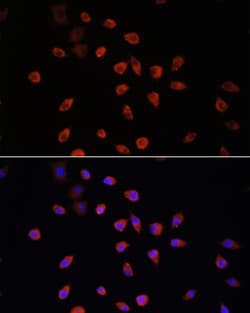 IFT88 Polyclonal Antibody:Antibodies, Polyclonal