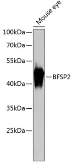 BFSP2 Polyclonal Antibody:Antibodies, Polyclonal