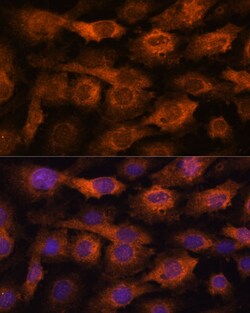 Invitrogen IFITM3 Polyclonal Antibody 100 &mu;L | Buy Online | Invitrogen&trade; | Fisher Scientific