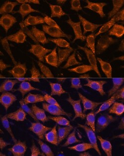 Invitrogen IFITM3 Polyclonal Antibody 100 &mu;L | Buy Online | Invitrogen&trade; | Fisher Scientific