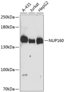 Invitrogen NUP160 Polyclonal Antibody 100 &mu;L; Unconjugated:Antibodies,