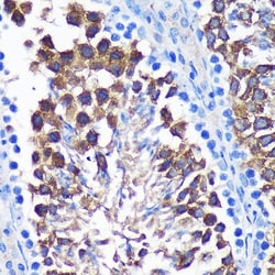 Invitrogen SENP1 Polyclonal Antibody 100 &mu;L; Unconjugated:Antibodies,