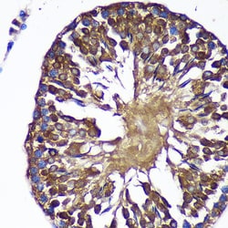 Invitrogen SENP1 Polyclonal Antibody 100 &mu;L; Unconjugated:Antibodies,