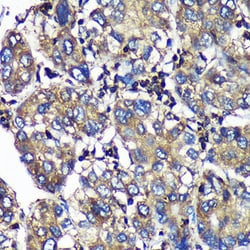 Invitrogen SENP1 Polyclonal Antibody 100 &mu;L; Unconjugated:Antibodies,