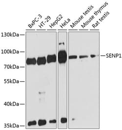 Invitrogen SENP1 Polyclonal Antibody 100 &mu;L; Unconjugated:Antibodies,