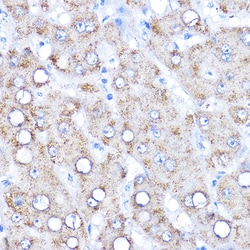 Invitrogen AADAT Polyclonal Antibody 100 &mu;L; Unconjugated:Antibodies,