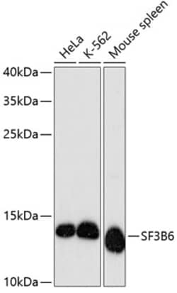 Invitrogen SF3B14 Polyclonal Antibody 100 &mu;L; Unconjugated:Antibodies,