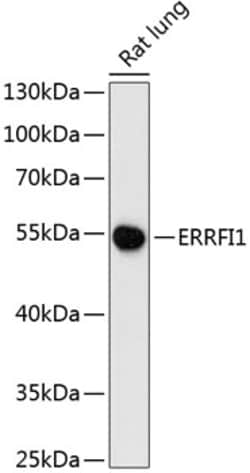 Invitrogen Mig-6 Polyclonal Antibody 100 &mu;L; Unconjugated:Antibodies,
