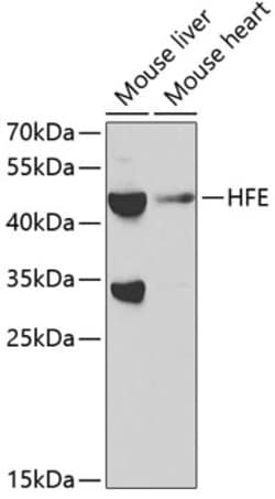 Invitrogen HFE Polyclonal Antibody 100 &mu;L | Buy Online | Invitrogen&trade; | Fisher Scientific