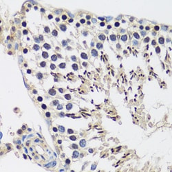 Invitrogen Casc5 Polyclonal Antibody 100 &mu;L; Unconjugated:Antibodies,