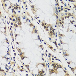 Invitrogen Casc5 Polyclonal Antibody 100 &mu;L; Unconjugated:Antibodies,