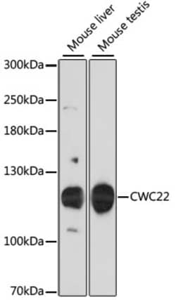 Invitrogen CWC22 Polyclonal Antibody 100 &mu;L; Unconjugated:Antibodies,