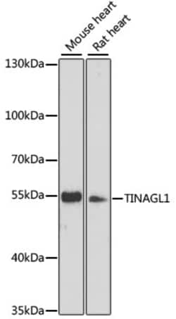 TINAGL1 Polyclonal Antibody:Antibodies, Polyclonal