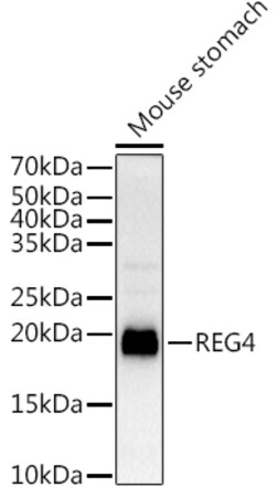 Invitrogen REG4 Polyclonal Antibody 100 &mu;L; Unconjugated:Antibodies,