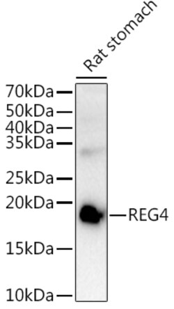 Invitrogen REG4 Polyclonal Antibody 100 &mu;L; Unconjugated:Antibodies,