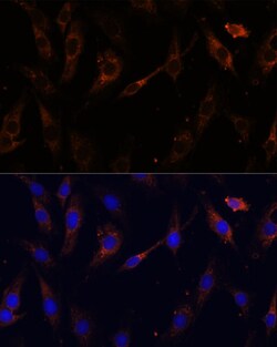 VPS25 Polyclonal Antibody:Antibodies, Polyclonal