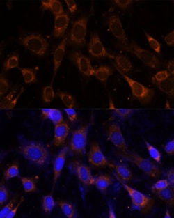 VPS25 Polyclonal Antibody:Antibodies, Polyclonal