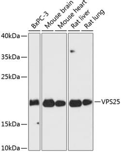 VPS25 Polyclonal Antibody:Antibodies, Polyclonal