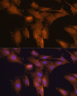 Invitrogen TSLP Polyclonal Antibody 100 &mu;L; Unconjugated:Antibodies,