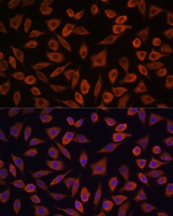 Invitrogen TSLP Polyclonal Antibody 100 &mu;L; Unconjugated:Antibodies,