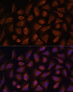 Invitrogen TSLP Polyclonal Antibody 100 &mu;L; Unconjugated:Antibodies,