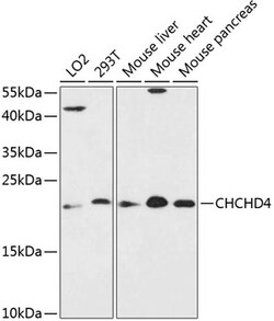 CHCHD4 Polyclonal Antibody:Antibodies, Polyclonal