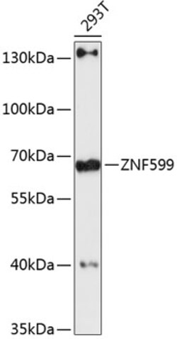 Invitrogen ZNF599 Polyclonal Antibody 100 &mu;L; Unconjugated:Antibodies,
