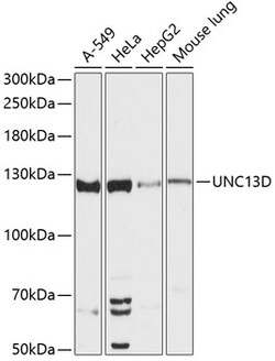 Munc13-4 Polyclonal Antibody:Antibodies, Polyclonal