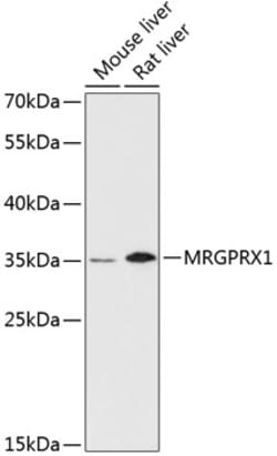 Invitrogen MRGPRX1 Polyclonal Antibody 100 &mu;L; Unconjugated:Antibodies,