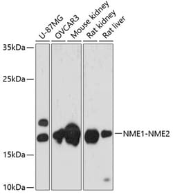 Invitrogen NME1/NME2 Polyclonal Antibody 100 &mu;L; Unconjugated:Antibodies,