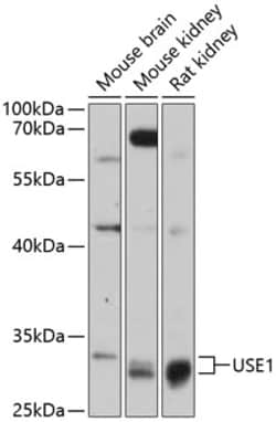 USE1 Polyclonal Antibody 100 &mu;L | Buy Online | Invitrogen | Fisher Scientific