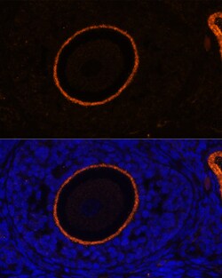 Invitrogen ZP3 Polyclonal Antibody 100 &mu;L; Unconjugated:Antibodies,