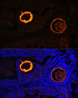 Invitrogen ZP3 Polyclonal Antibody 100 &mu;L; Unconjugated:Antibodies,