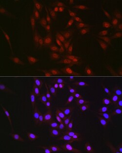RBM14 Polyclonal Antibody:Antibodies, Polyclonal