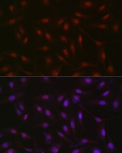 RBM14 Polyclonal Antibody:Antibodies, Polyclonal