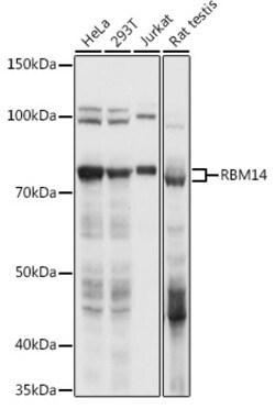 RBM14 Polyclonal Antibody:Antibodies, Polyclonal