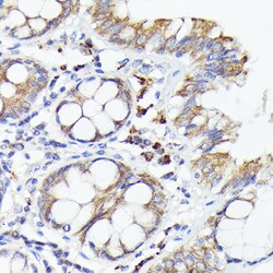 Invitrogen IL-1 alpha Polyclonal Antibody 100 &mu;L; Unconjugated:Antibodies,