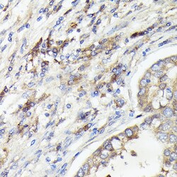 Invitrogen IL-1 alpha Polyclonal Antibody 100 &mu;L; Unconjugated:Antibodies,