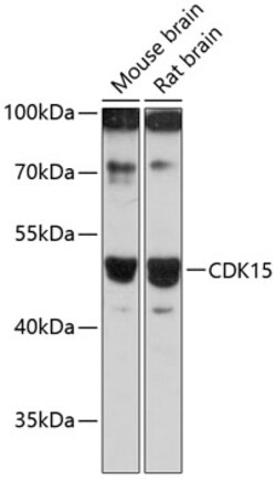 PFTK2 Polyclonal Antibody 100 &mu;L | Buy Online | Thermo Scientific | Fisher Scientific
