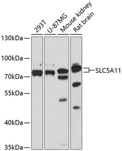 SLC5A11 Polyclonal Antibody, Invitrogen 100 &mu;L; Unconjugated:Antibodies,