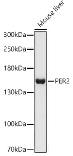 Invitrogen PER2 Polyclonal Antibody 100 &mu;L | Buy Online | Invitrogen&trade; | Fisher Scientific