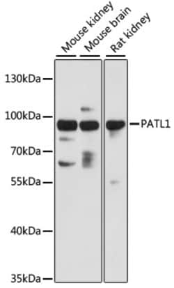 PATL1 Polyclonal Antibody:Antibodies, Polyclonal
