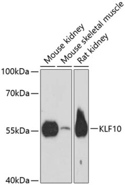 Invitrogen KLF10 Polyclonal Antibody 100 μL; Unconjugated:Antibodies,